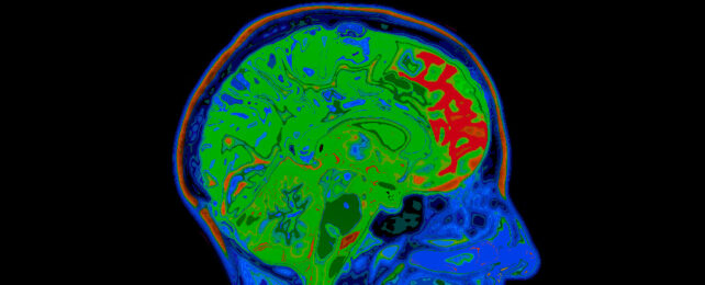 MRI of the human brain
