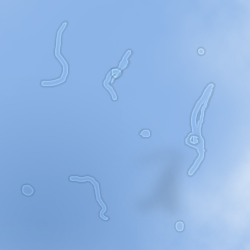 A simulated image of floaters, or muscae volitantes, against a blue sky.