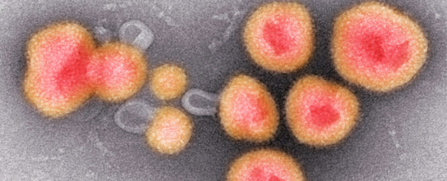 Viruses under microscope