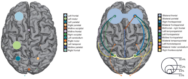 An illustration depicting two brains with different regions colored to depict regions targeted. 